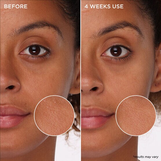 PORE CARE T�NICO EM ESPUMA TIGHT N TONED